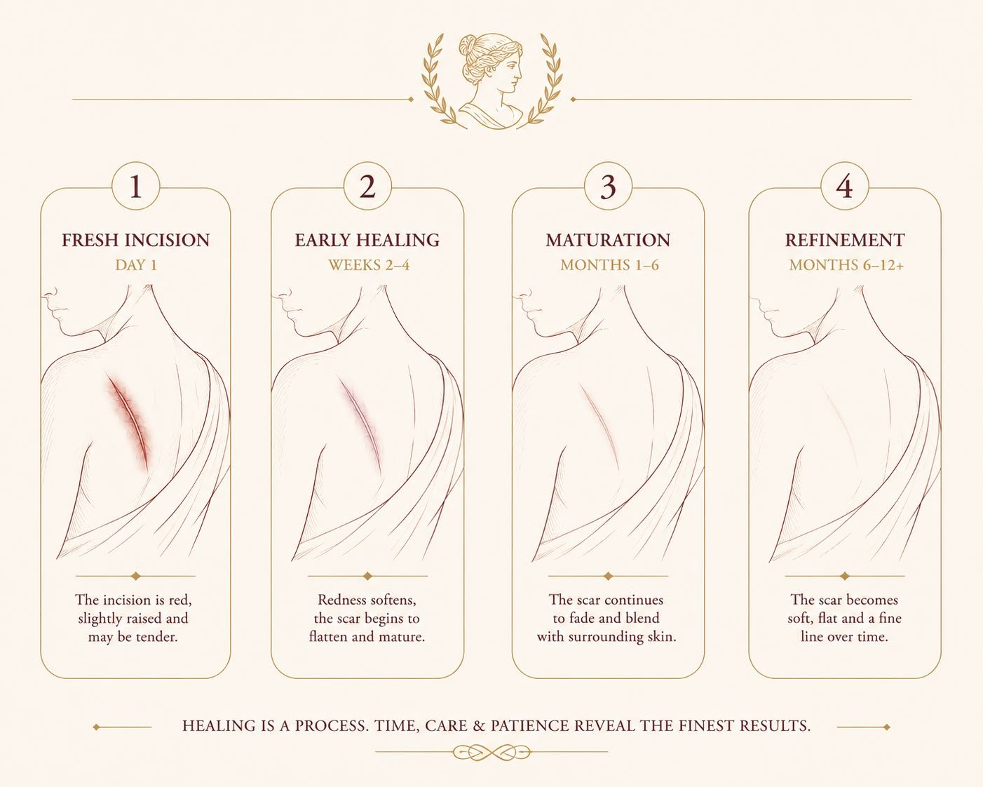 Illustration showing the stages of surgical scar healing and maturation